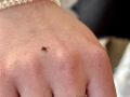 Как защитить детей от клещей: советы Роспотребнадзора на летние прогулки